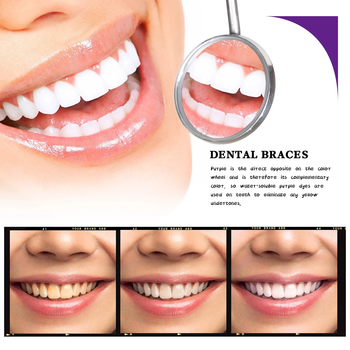 V34 Teeth Whitening Mousse – Stain Removal & Gum Care