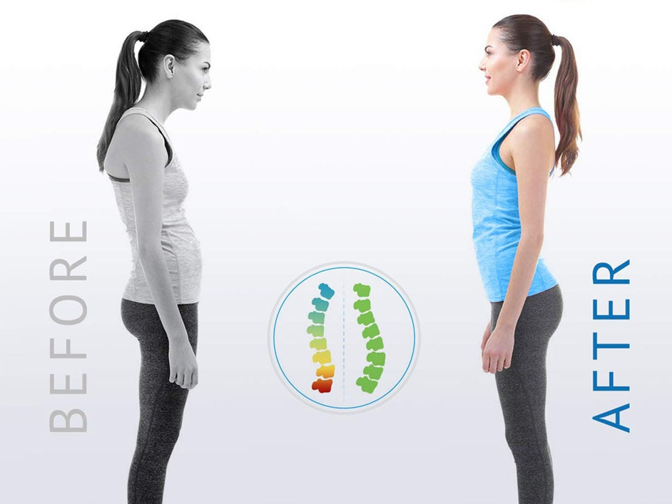 posture-corrector